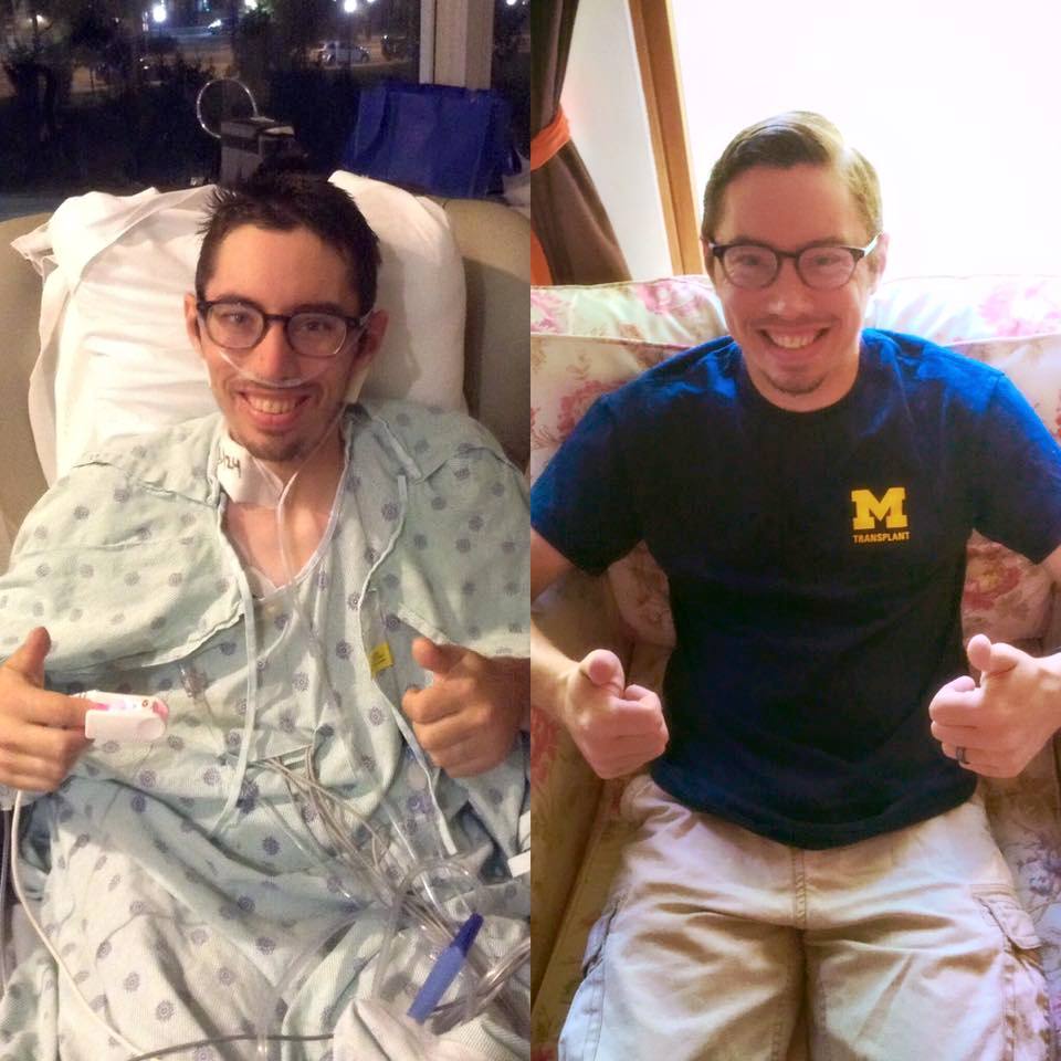 Evin Green before and after double lung transplant